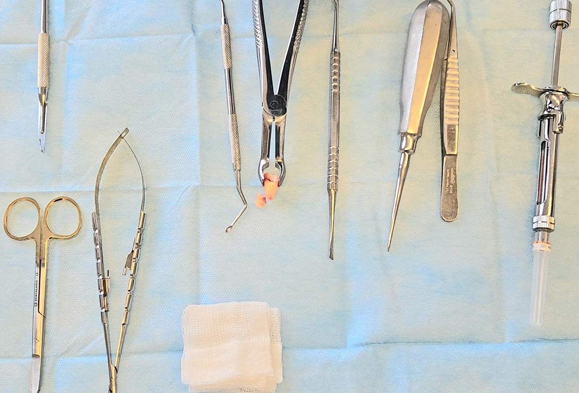 Chirurgia stomatologiczna – Dent-a-Clinic Bardo