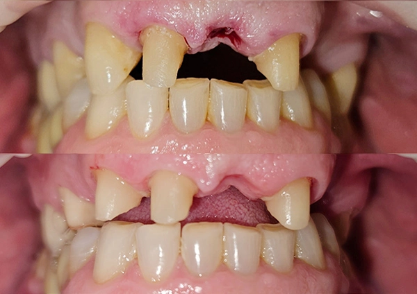 Before-Metamorfoza 2